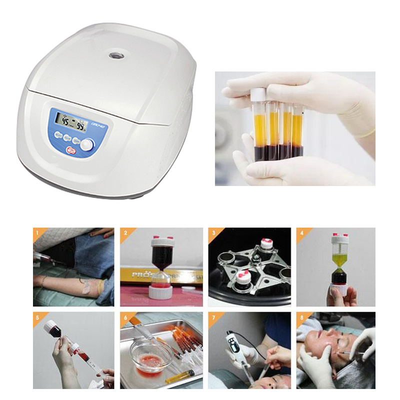 Best Seller Medical Blood PRP  - Medical Lab Center recension och pris
